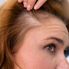 Óleo desponta como 'Minoxidil natural' com resultados positivos contra queda de cabelo