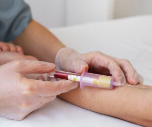 Novo exame eleva precis&atilde;o no diagn&oacute;stico de Alzheimer para 94%.