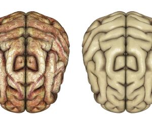 O que acelera o envelhecimento cerebral? Cientistas apontam nova prote&iacute;na como respons&aacute;vel.