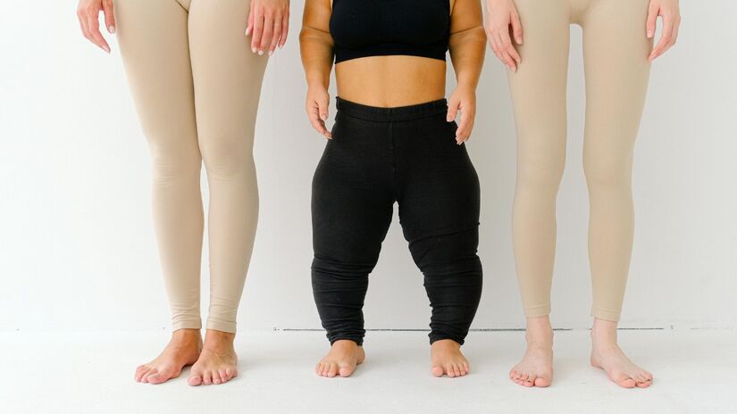 Problemas com altura muitas em muitos casos são apenas questões estéticas / Pexels