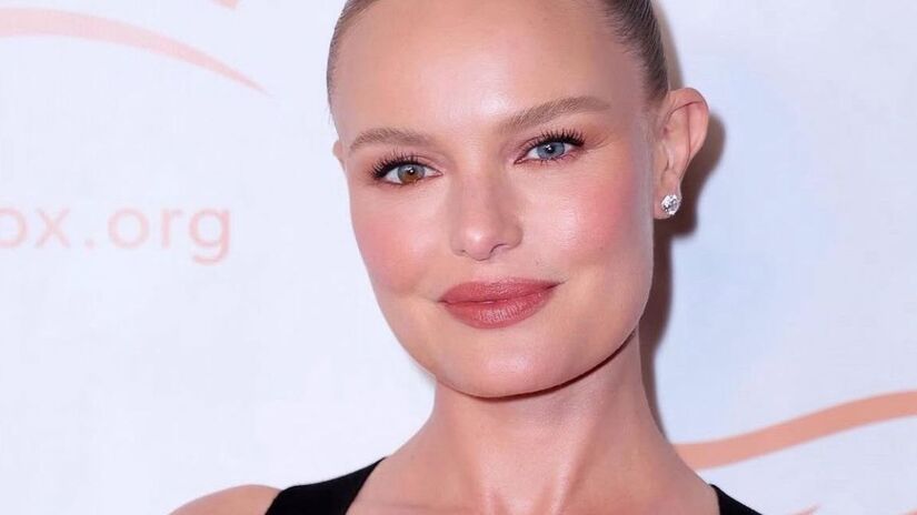 A heterocromia é uma condição em que um indivíduo apresenta olhos de cores diferentes. É rara e pode ser causada por questões genéticas ou de saúde. A atriz Kate Bosworth é uma das celebridades conhecida por ter essa característica - Reprodução/Instagram
