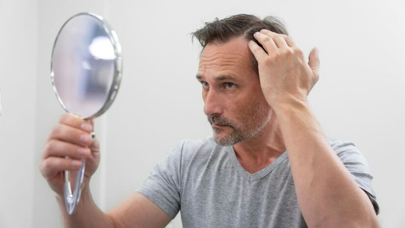 É verdade: Uma dieta com deficiência de vitaminas pode ser muito prejudicial para nosso cabelo, como ao resto do corpo.