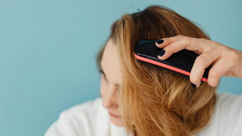 É mito: A calvície não afeta só os homens, pelo contrario um número considerável de mulheres sofrem com a queda de cabelo