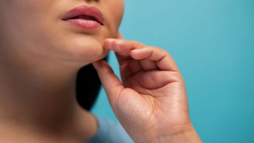 Além da febre, fatores como exposição ao sol e fadiga também podem desencadear crises de herpes labial