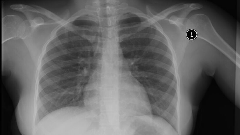 Um h&aacute;bito simples pode ajudar a proteger os ossos na velhice: pesquisadores apontam benef&iacute;cios do ch&aacute; para a sa&uacute;de &oacute;ssea de mulheres idosas