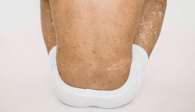 A melhora n&atilde;o fica s&oacute; no espelho: estudos indicam que pessoas que vivenciam a nudez de forma consciente relatam mais bem-estar e satisfa&ccedil;&atilde;o com a vida/Pixabay