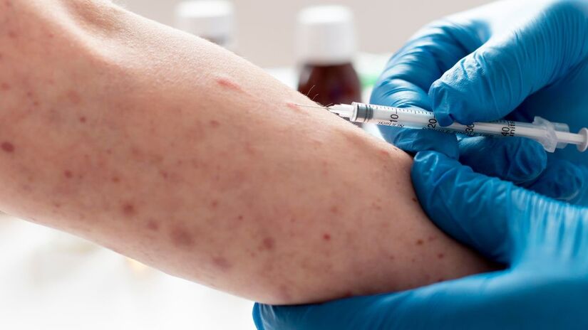 Praia Grande não registra casos confirmados de mpox em 2026/Pexels
