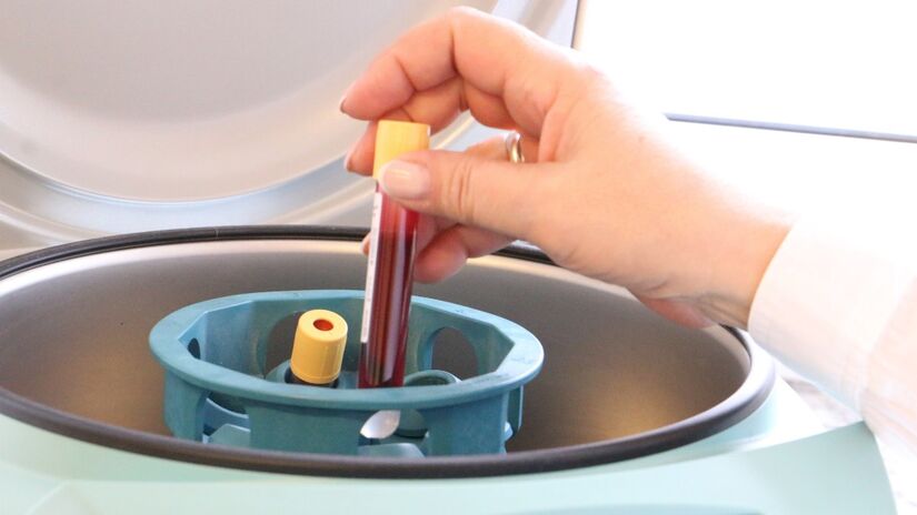 Investigação por meio do sangue pode revelar infecções e doenças crônicas / Pixabay