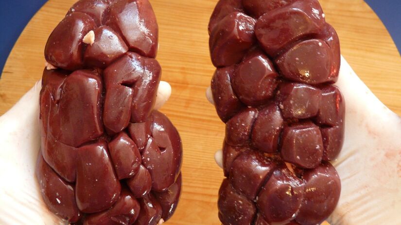 Reduzir o consumo excessivo de sal ajuda a prevenir sobrecarga renal / Pixabay