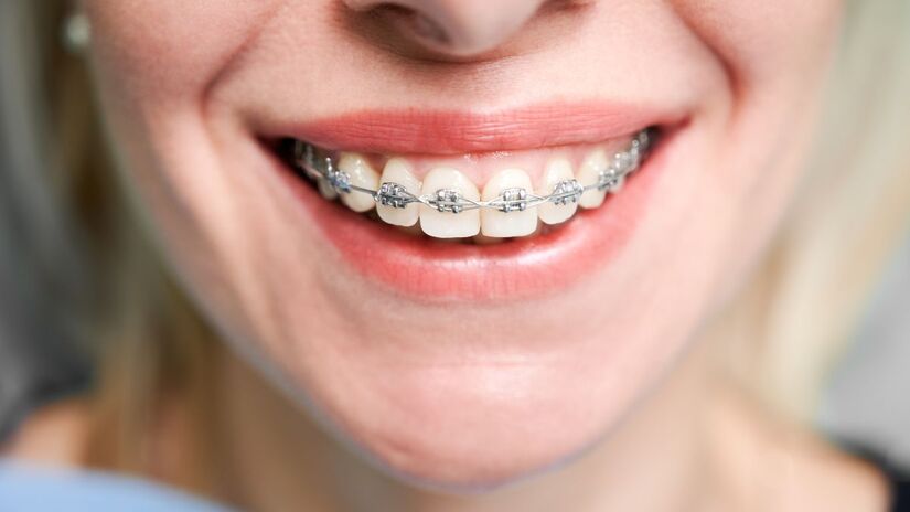 Dentes não ficam totalmente fixos ao longo da vida: mudanças naturais podem provocar movimentações dentárias, mesmo após o tratamento ortodôntico. Freepik/ArtPhoto_studio
