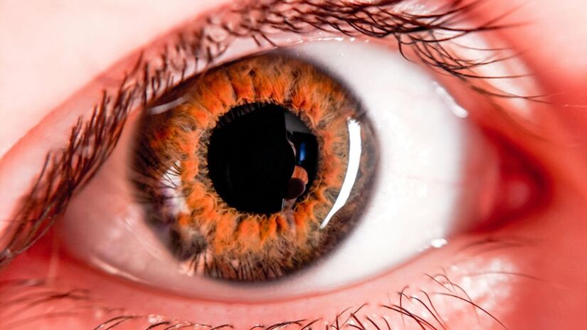 Hipótese inicial aponta possível contaminação por bactéria, mas causa exata ainda é apurada /Pexels