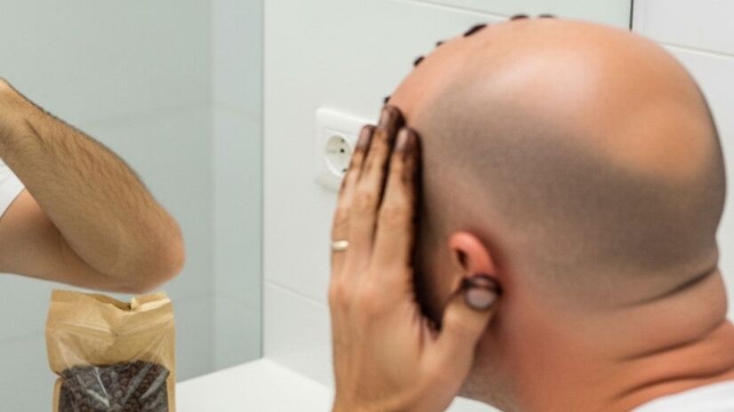 Cafeína presente no café pode estimular a circulação no couro cabeludo /ImageFX