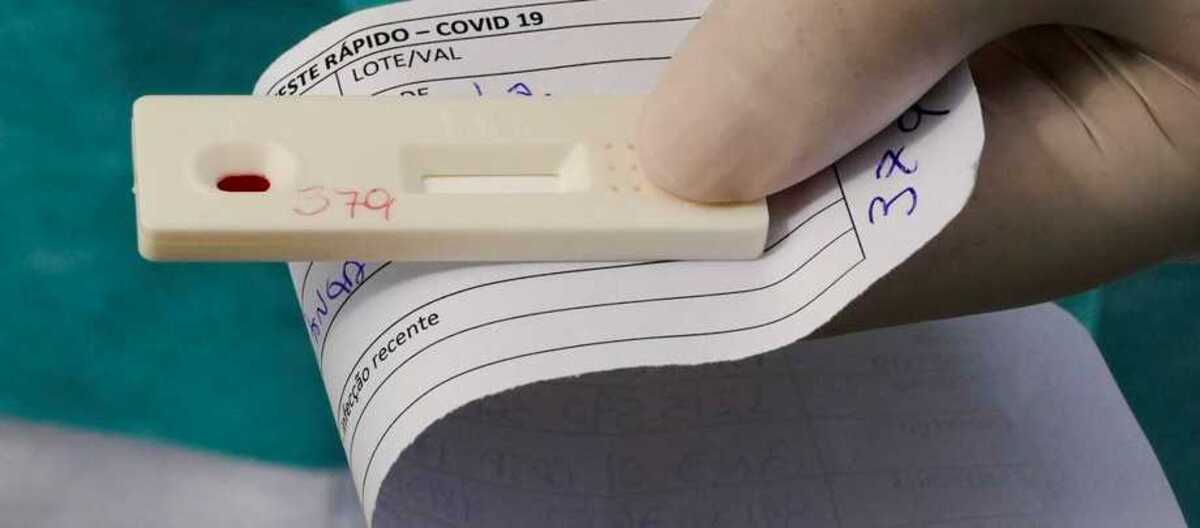 Covid 19 Pessoas Ainda Confundem Quais Testes Podem Ser Feitos Em Farmacia Diario Do Litoral