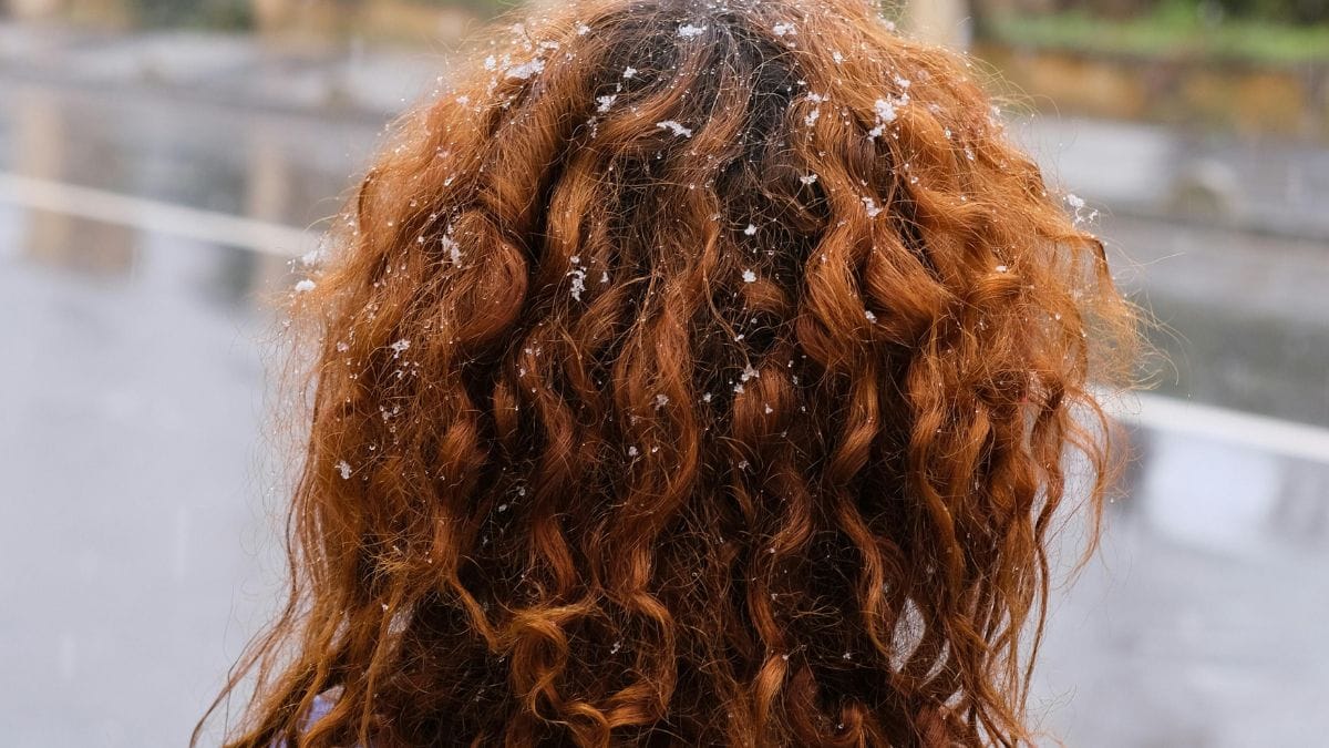 Mulher escondendo o rosto em meio a neve