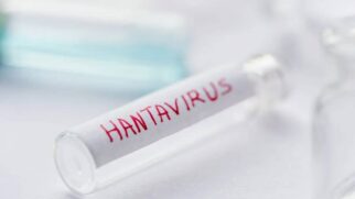 A imagem mostra um frasco que contém amostras do Hantavirus