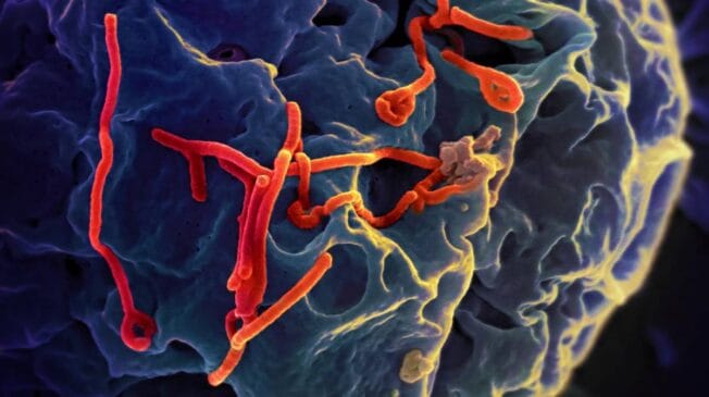 ebola-virus