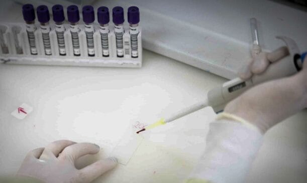 Teste para casos de ebola