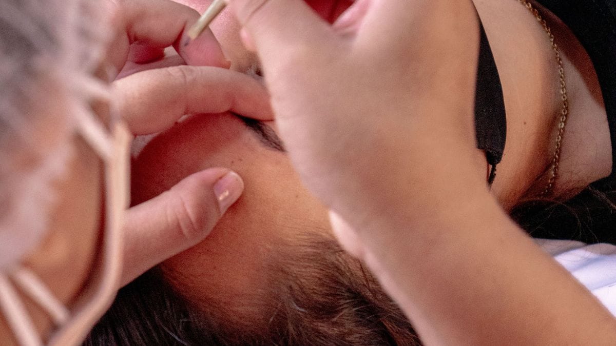 Mulher se prepara para transplante de sobrancelha