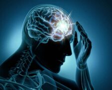 Epilepsia