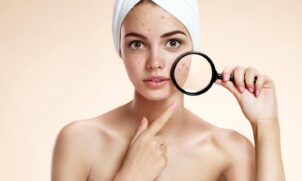 Dr. Bianca afirma que uma dieta com baixo teor de açúcar pode melhorar a acne