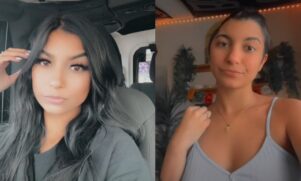Jovem relatou no TikTok como foi procedimento e o que gerou sua condição