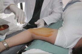 O aumento gradativo dos implantes possibilitou a redução em 40% da gravidez na adolescência na Cidade, em pouco mais de cinco anos