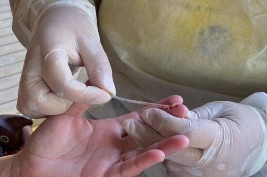 A paciente deu entrada no hospital em estado grave e, pelos sintomas apresentados, ficou claro para eles que se tratava de uma doença no fígado