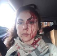 Procuradora é agredida por colega em Registro