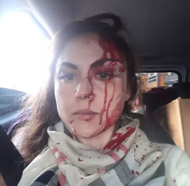 Procuradora é agredida por colega em Registro
