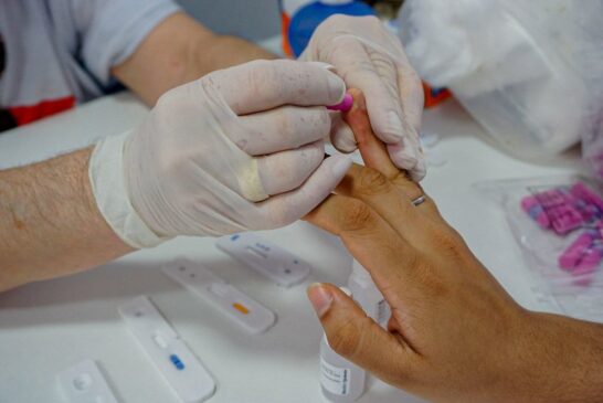 Testes para detectar HIV, sífilis e hepatites são realizados em Bertioga