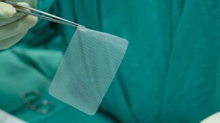 As próteses em formato de tela utilizadas nas cirurgias para tratamento de pacientes com hérnias da parede abdominal reduzem o risco de recidiva