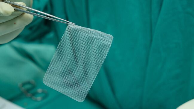 As próteses em formato de tela utilizadas nas cirurgias para tratamento de pacientes com hérnias da parede abdominal reduzem o risco de recidiva