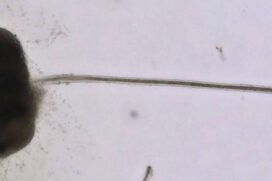 Folículo capilar cultivado em laboratório por cientistas da Universidade Nacional de Yokohama, Japão -
