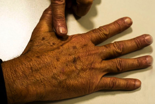 Segundo dados do Instituto Nacional do Câncer (INCA), é previsto que cerca de 704 mil novos casos de câncer por ano sejam diagnosticados no triênio 2023/2025