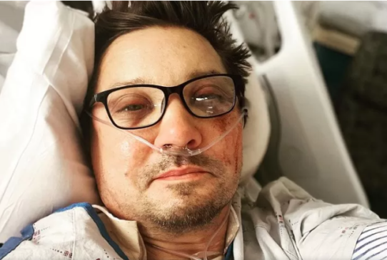 Jeremy Renner publicou uma foto para agradecer pelas mensagens de carinho dos fãs