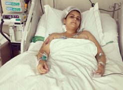 Karina Rodini descobriu a neurofibromatose, doença responsável por tumores gigantes, aos dois anos de idade
