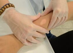 Todos podem ser acometidos pela doença, que tem como principal meio de transmissão as vias respiratórias de uma pessoa não tratada