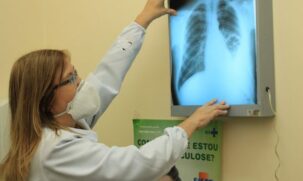 Os municípios aplicarão um interrogatório sobre tosse para a identificação de sintomáticos respiratórios