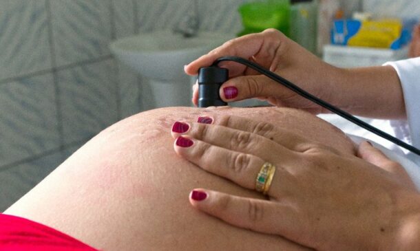 A ultrassonografia transvaginal é um exame de imagem não invasivo