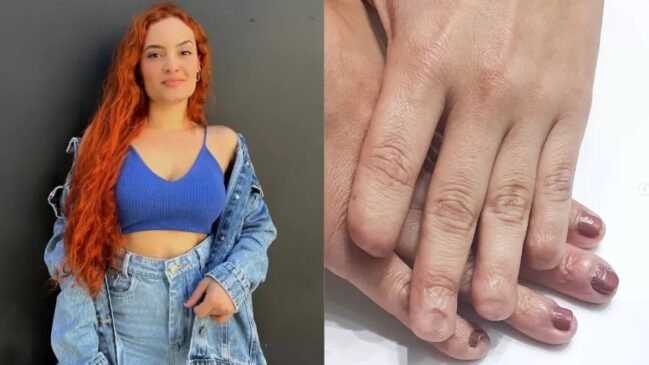 Tudo começou em 2014, quando Jaine tinha 22 anos e um médico encontrou o cisto no corpo dela