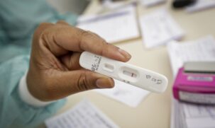 A taxa de positividade de exames RT-PCR passou de 2%, na última semana de julho, para 20%, entre 6 e 12 de agosto