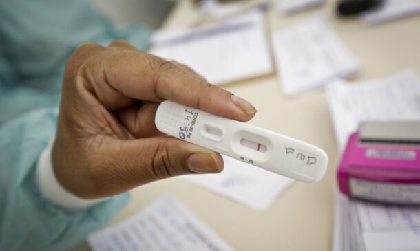 A taxa de positividade de exames RT-PCR passou de 2%, na última semana de julho, para 20%, entre 6 e 12 de agosto