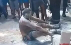 Um homem sofreu queimaduras pelo corpo ao tentar atear fogo na ex-companheira em Fortaleza.