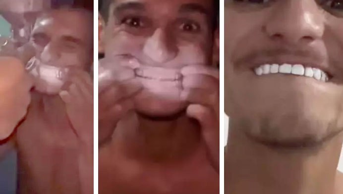 internauta usou tinta de parede e postou a 'dica' na internet, internauta usou tinta de parede e postou a 'dica' na internet e dentista condenou o ato e deu dicas sobre saúde bucal