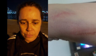 Vivian sofreu alguns ferimentos leves durante o acidente