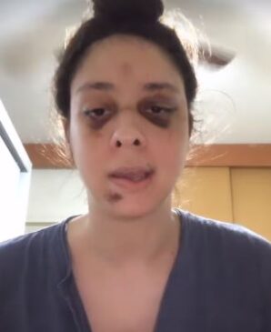 Ator Victor Meyniel foi agredido no último domingo (3)