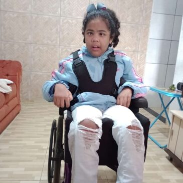 Natália de 11 anos, sofreu um acidente grave e ficou com sequelas