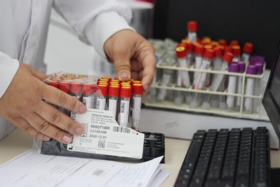 Os pacientes das unidades que não abrirem neste sábado poderão ir até a mais próxima que estiver aberta