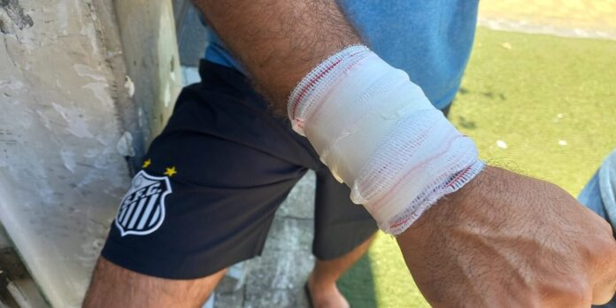 Morador teve braço cortado após vândalo dar soco em sua janela