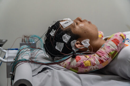 De acordo com especialistas, o EEG é um exame que analisa a atividade elétrica cerebral espontânea, captada por meio da utilização de eletrodos colocados no couro cabeludo